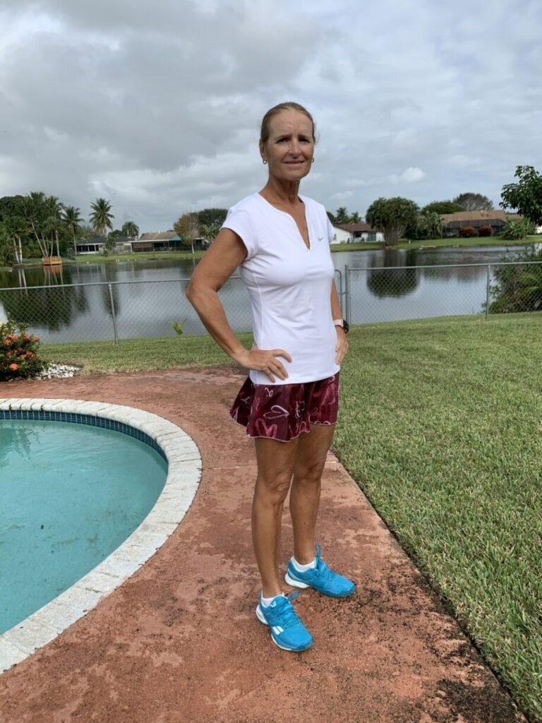 Cecilia-DEC,-2020 after fat loss